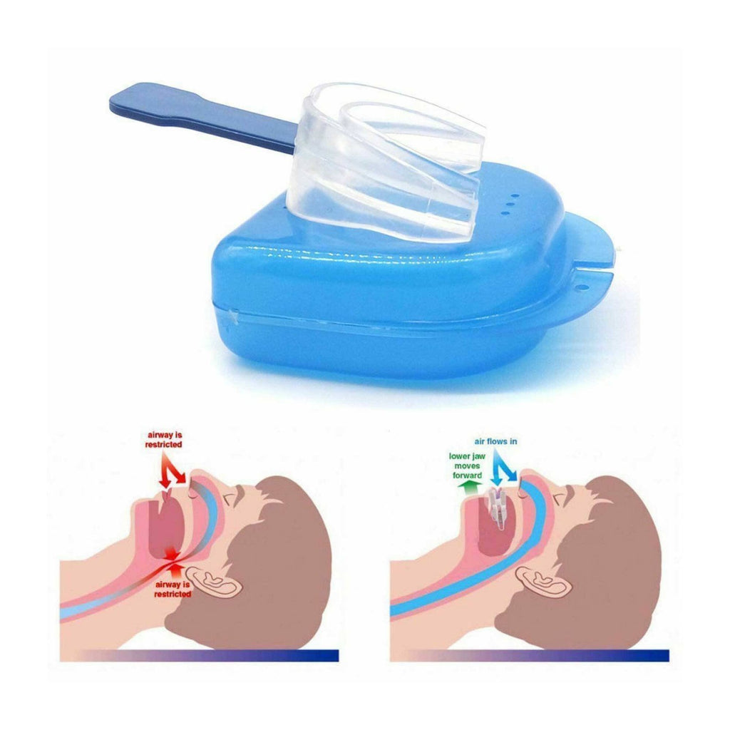 Anti Snoring Mouth Guard for Improved Sleep and Breathing